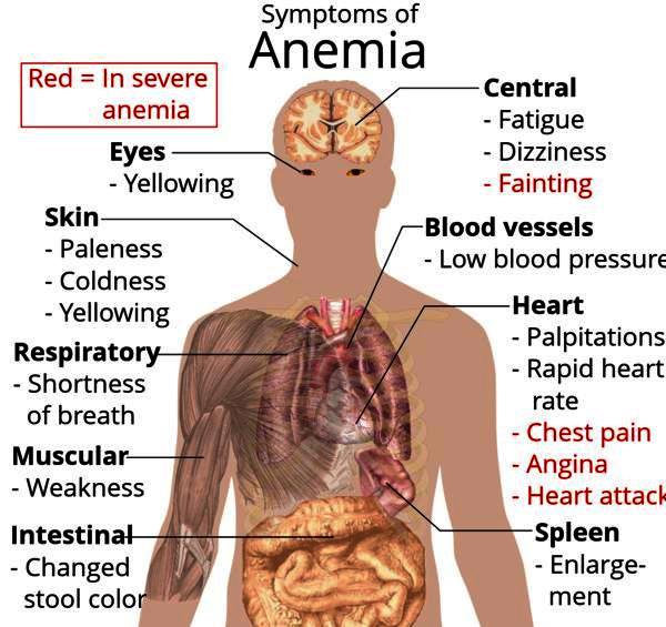 Anaemia symptoms
