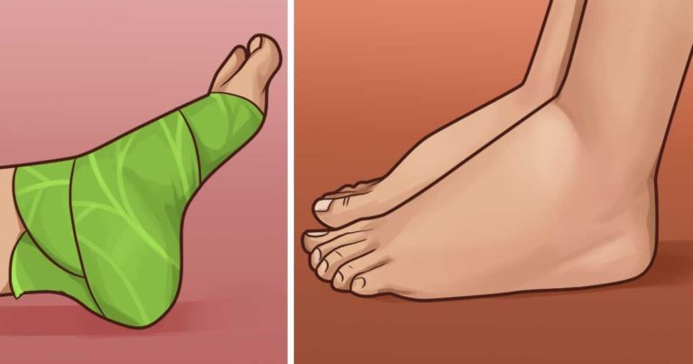 cabbage wrap for swollen feet